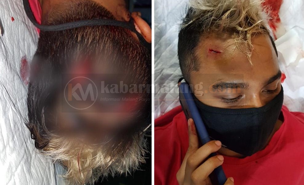 Cemburu, Teman Facebook Istri Diroti Kalung 29 luka korban