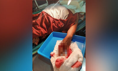 Suami Bacok Istri Di Malang, Kepala Luka, Jemari Tangan Kiri Terputus