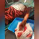 Suami Bacok Istri Di Malang, Kepala Luka, Jemari Tangan Kiri Terputus